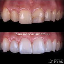 Pin On Dental Assistant