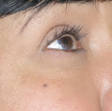 | mtv tattoos are permanent so people tend to. Tattoo Removal Medical Misc Bellametrics