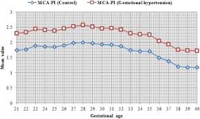 Effects Of Gestational Hypertension In The Pulsatility Index