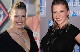 Similarly, another of a kind is reconstructive surgery that revamps abnormality caused by birth defects, accidents, and medical conditions. Jodie Sweetin Plastic Surgery Celebrity Plastic Surgery