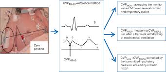 Following are the assumptions of cvp analysis cvp analysis assumes that there are no changes in the price and variable cost per unit irrespective of change in time period and relevant range. Comparison Of Different Techniques Of Central Venous Pressure Measurement In Mechanically Ventilated Critically Ill Patients British Journal Of Anaesthesia