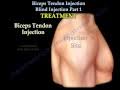 Image result for Biceps Tendon Injection