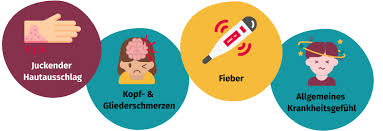 Windpocken — symptome und behandlung. Windpocken Ursachen Behandlung Und Vorbeugung Gesund Bund De