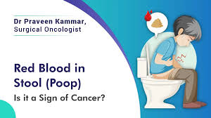 Image result for Blood in stool
