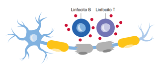 14 de junio de 2021 20:25 cest Esclerosis Multiple Primaria Progresiva Diferencias Roche Pacientes