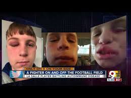 La Salle freshman lineman Gavin Robbins perseveres despite rare disease