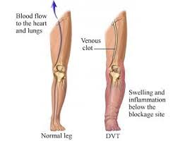 Pin On Anatomy