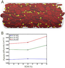Image result for Red Cell Distribution Width