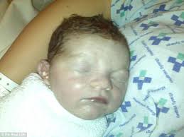 Luton boy forgets to breathe due to CCHS disorder