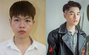 Công nghệ thẩm mỹ ở bệnh viện kangnam. Bac SÄ© Kangnam Chia Sáº» Qua Trinh Pháº«u Thuáº­t Keo Dai 5 Tiáº¿ng Cá»§a Ä'á»©c Phuc
