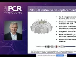 Evoque Shows Feasibility In Transcatheter Mitral Valve Repair Crtonline