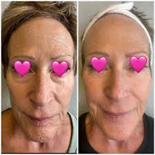 Donna Herskind (@donna.herskind) • Facebook