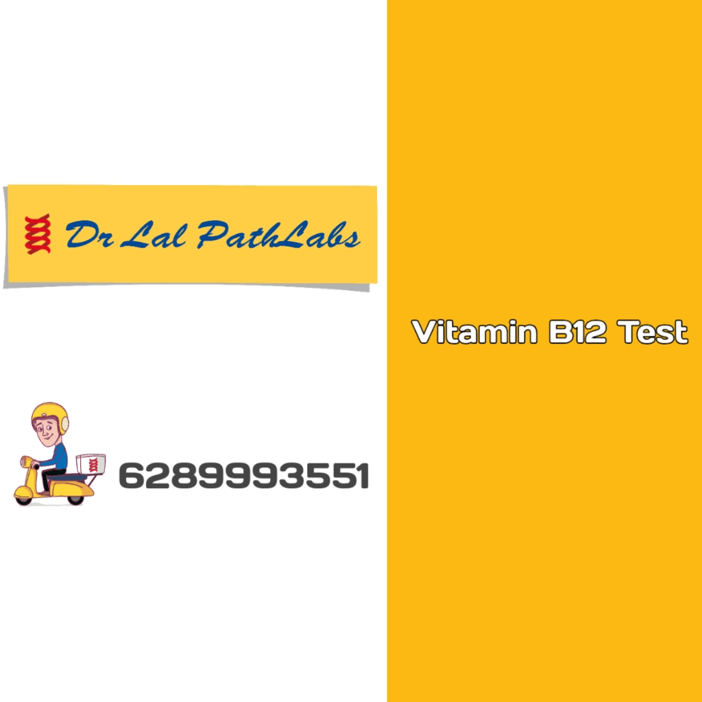 Vitamin B12 test product image
