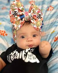 All in for Lucky Fin!! Hello, my name is Autumn! My mommy and daddy found  out at our 20 week ultrasound that I was gonna have a lucky fin due to  amniotic