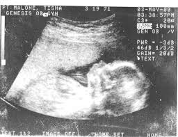 Peyton Elijah Christopher Malone Obituary