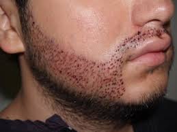 Facial hair, or the lack thereof, can require a lot of maintenance. Trend For Beards Leads To New Opportunities In Facial Hair Grooming