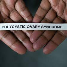 However, some research has found no relationship between the two. Overdiagnosis And Disease Labels The Case Of Polycystic Ovary Syndrome