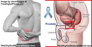 Although it is the most commonly diagnosed cancer in american women, breast cancer can impact people of all genders. Prostate Cancer Warning Signs And Symptoms You Shouldn T Ignore