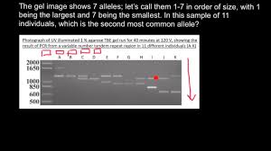 How To Understand Gel Electrophoresis Results 1 Youtube