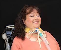 Brooke Ellison Of Stony Brook University On What You Should Do If Your  Employer Is Not Willing To Make Reasonable Accommodations For Your  Disability