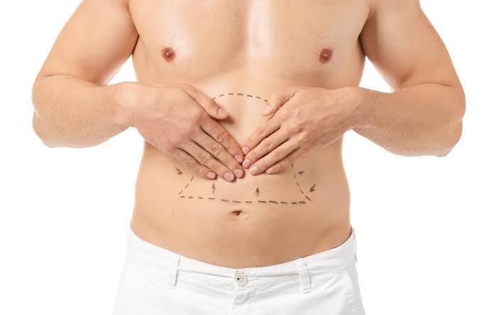 Male Tummy Tuck: Transform Your Confidence and Body Contour