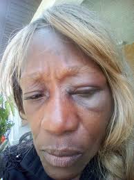 Throwing yourself infront of 14,000 pounds is not the brightest idea!😠😤  Missed him by a hair!!