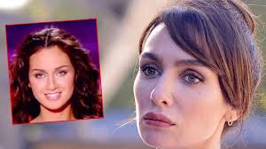 Survivor birleşme partisi güzellik yarışması! Birce Akalay Dan Estetik Aciklamasi