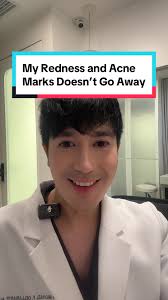 Celluma Vs Dermalux Face Therapy