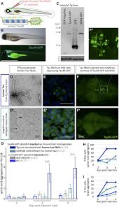Whether it's for function or style, hair clips are a helpful accessory for everyday use. Seizures Are A Druggable Mechanistic Link Between Tbi And Subsequent Tauopathy Elife