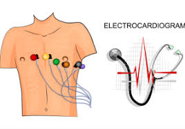 Image result for Electrocardiogram