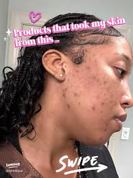 Honest Facewash Reviews: Choosing the Best Cleanser for Your Skin