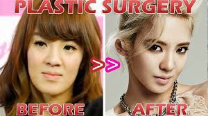 Blackpink Plastic Surgery Blackpink Reborn 2020