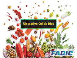 Usually, ulcerative colitis starts steadily and could be worse over time. Ulcerative Colitis Diet Plan What To Eat And Not Eat