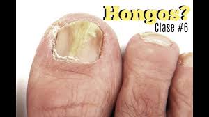 We did not find results for: Clase 6 Hongos En Las Unas Deko Unas Youtube