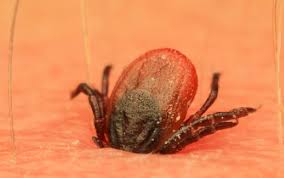 Voici Ce Que Vous Devez Faire En Cas De Morsure De Tique Astuces De Grand Mere Tiques Morsure De Tique Nature Et Sante