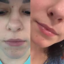 Touch & Glow Esthetics