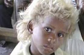 Now let's take a look at how we can use genetics to guess your baby's hair color. Genetics Of Hair Color Discover Magazine