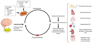 Image result for Autonomic Dysfunction