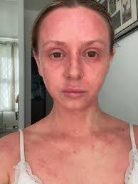 Anyone know of any mobile dog groomers or vet nurse etc who can come cut my  dogs nails in west end, im literally at my wits end wirh them,I've taken  him to