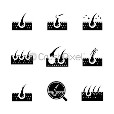 If hair follicles are damaged, the loss can be permanent. Hair Loss Black Glyph Icons Set On White Space Damaged Stock Vector Crushpixel