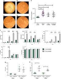 Examples of encapsulated in a sentence. Encapsulation Of Macrophages Enhances Their Retention And Angiogenic Potential Npj Regenerative Medicine