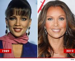 Patient Testimonials Celebrity Plastic Surgery Vanessa Williams Plastic Surgery