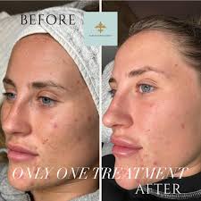 Bare Skin Philosophy