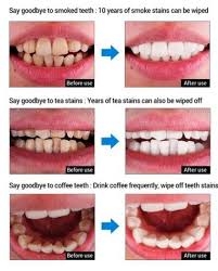Apart from brushing your teeth regularly, which might not be working as you wanted, there are other ways to remove coffee stains from your teeth. Lanbena Instant Teeth Whitner And Stain Remover Scale And Polish In A Bottle For Sale In Ashbourne Meath From Niiall132