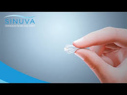 Reading around for nasal polyp stories, i've seen everything from weeks of misery to well, less than weeks of misery. Sinuva Sinus Implant Stamford Ct Ear Nose Throat Center Llp