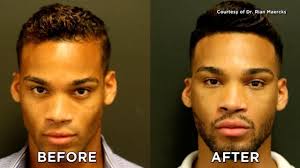 Add a mixture of cinnamon and olive oil together and apply on your. How To Get Fuller Lips For Guys Magnum Workshop