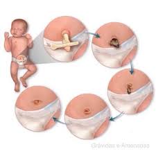 Como Cuidar Do Umbigo Do Bebe Dicas E Cuidados Portal Clube De Assinaturas Maes De Primeira Viagem Dicas De Amamentacao Cuidados Com O Bebe
