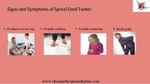 When claire was sick i used caring bridge to communicate updates to the myriads of supportive people who were following her story throughout treatment. Pediatric Brain Tumor Treatment In Chennai Child Brain Tumor Surger