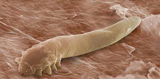 Image result for Demodex brevis