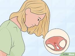 Jun 13, 2016 · typically, urine will have an odor. 3 Ways To Identify An Amniotic Fluid Leak Wikihow